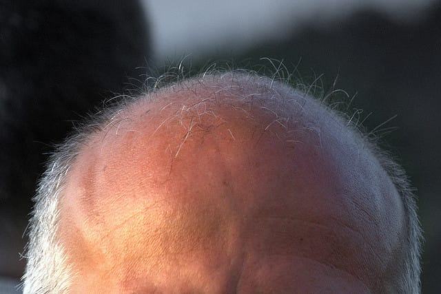 Broccoli für die Haare